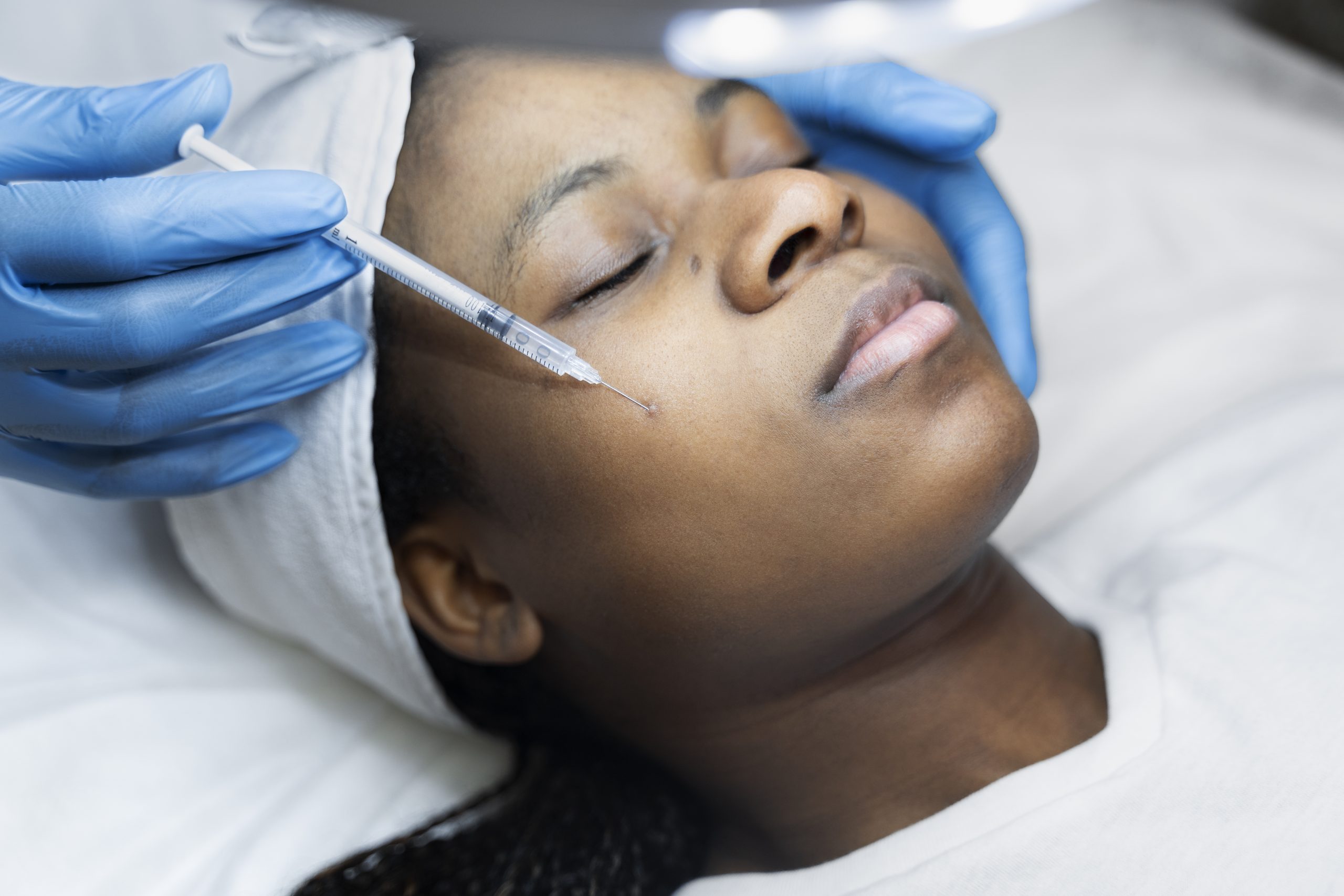 person getting micro needling beauty treatment